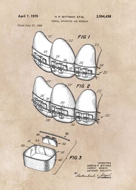 patent art Wittman 1970 Dental apparatus and metho