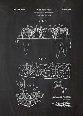 1948 Dental Bridge