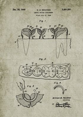 1948 Dental Bridge