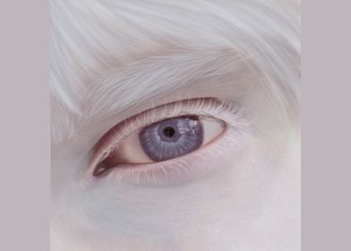 Albino Eye 