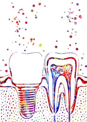 Human teeth and implant