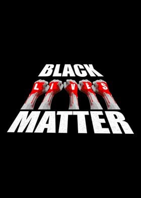 Black Matter