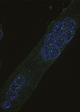 Chromatin Accessibility