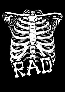 Radiology Ribcage XRay