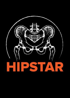 Hipstar Hip Surgery