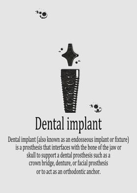 Dental implant