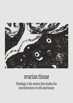 ovarian tissue