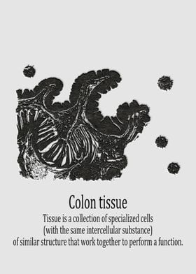 colonic tissue