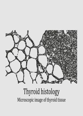 Thyroid tissue