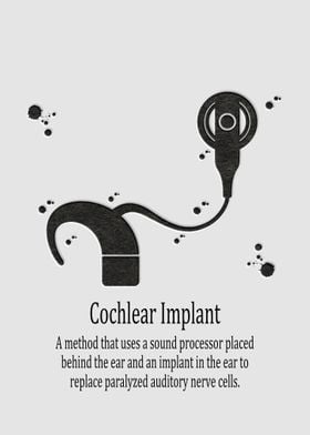 Cochlear Implant