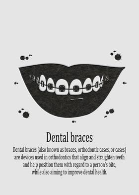 Dental braces