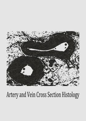 Artery and Vein Cross Sect