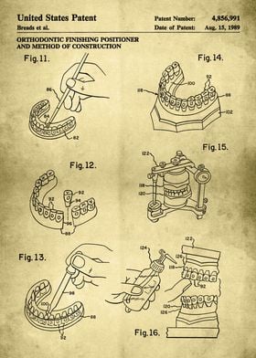 Orthodontic Finish Patent