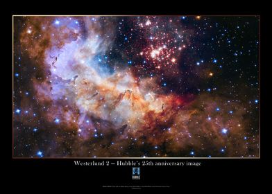 Westerlund 2