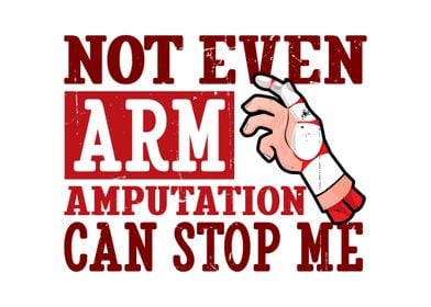 Arm Amputee