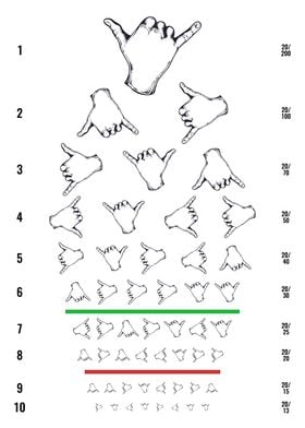 Metal Finger Eye Test