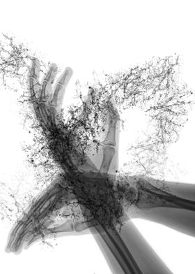 X ray of hands