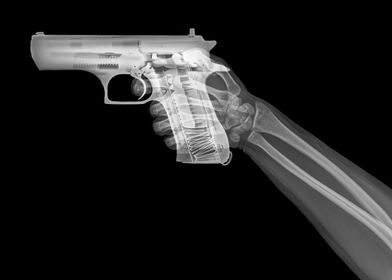Handgun under x ray 