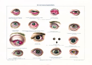 Poster Medicine Eye Diseases | Vintage