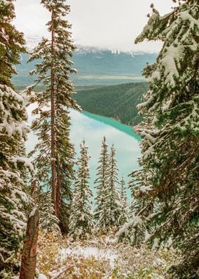 Lake Louise | Banff National Park | Snowy Mountain Lake View