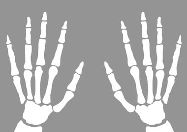 XRay Of Hands